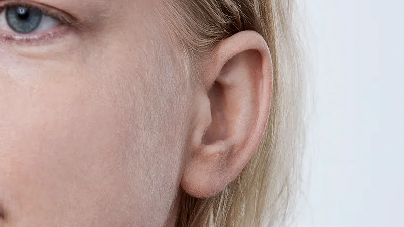 Oticon Opn&trade; G&ouml;r&uuml;nmez Kanal İ&ccedil;i (IIC)