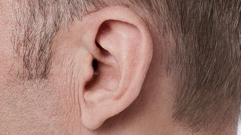 Oticon Opn&trade; G&ouml;r&uuml;nmez Kanal İ&ccedil;i (IIC)